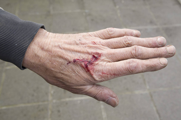 mano sinistra sporca e sanguinaria di un lavoratore di schiena - Foto, immagini