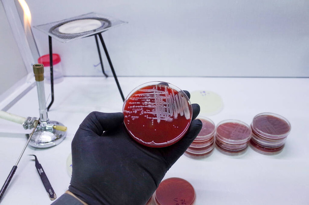 Agar Ortamı Bakteri Kültürü - Fotoğraf, Görsel