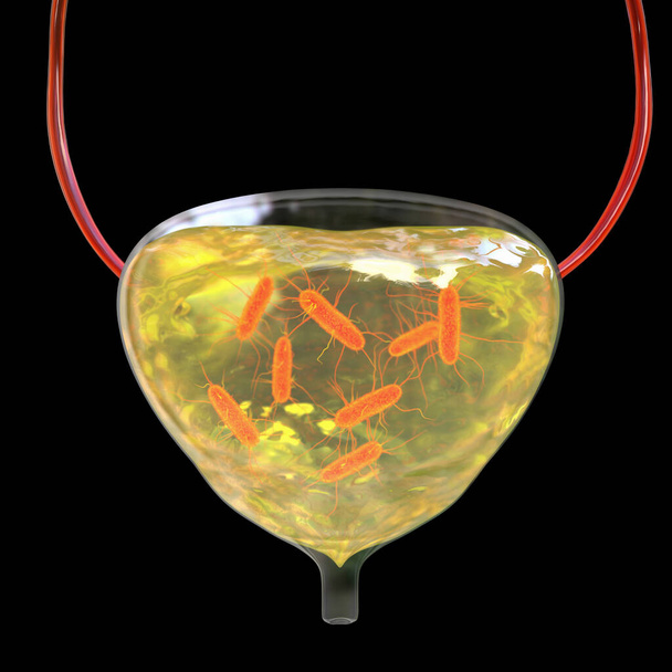 Cistite, infecção bacteriana da bexiga urinária, ilustração conceitual 3D mostrando bactérias flutuando na urina - Foto, Imagem