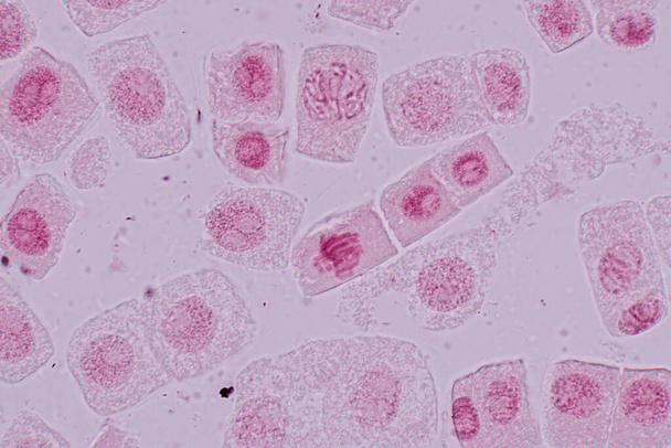 Mitose cel in de Wortelpunt van Ui onder een microscoop. - Foto, afbeelding