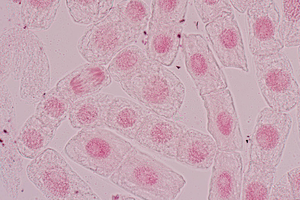 Komórka mitozy w korzeniowej końcówce cebuli pod mikroskopem. - Zdjęcie, obraz