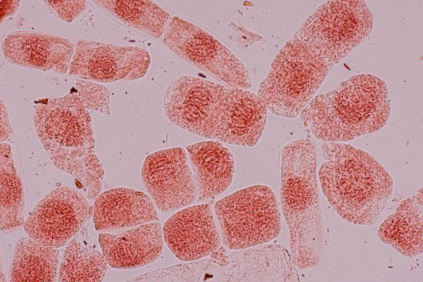 Клітина мітозу в кінчику кореня цибулі під мікроскопом
. - Фото, зображення
