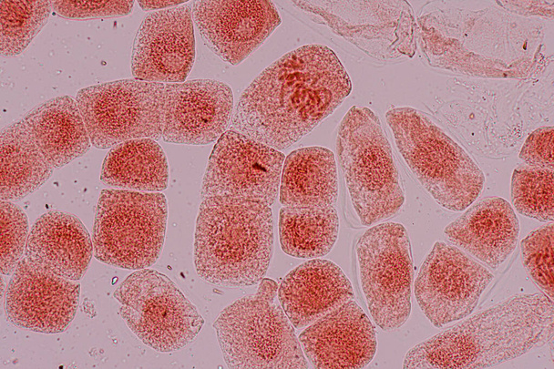 Mitóza buňky v kořenové špičce cibule pod mikroskopem. - Fotografie, Obrázek