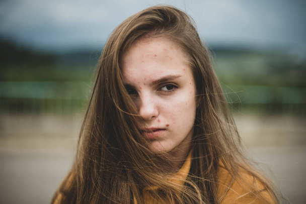 Portrét mladé krásné roztomilé dospívající dívka žena s frackles a problematické pleti na přirozeném pozadí. Dívčí síla, tělo pozitivní, skuteční lidé. - Fotografie, Obrázek