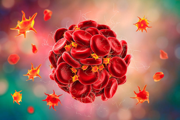 Тромб из красных кровяных телец, тромбоцитов и нитей фибринового белка. Тромб, 3D иллюстрация. Тромбоз, тромбоэмболия, свертывание крови - Фото, изображение