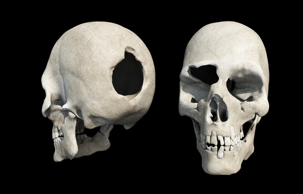 Cráneo del agujero de bala en negro
 - Foto, Imagen