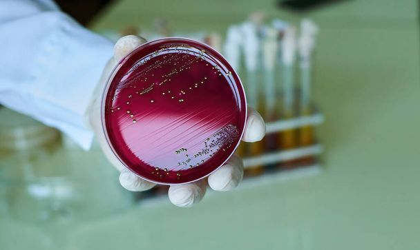bacterial colonies of E coli on medium plate hold in hand of researcher - Photo, Image