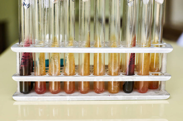 Δοκιμαστικός σωλήνας στον κάτοχο με μέσο Kligler agar για το οποίο υπάρχουν υπόνοιες ότι περιέχει σαλμονέλα και e coli - Φωτογραφία, εικόνα