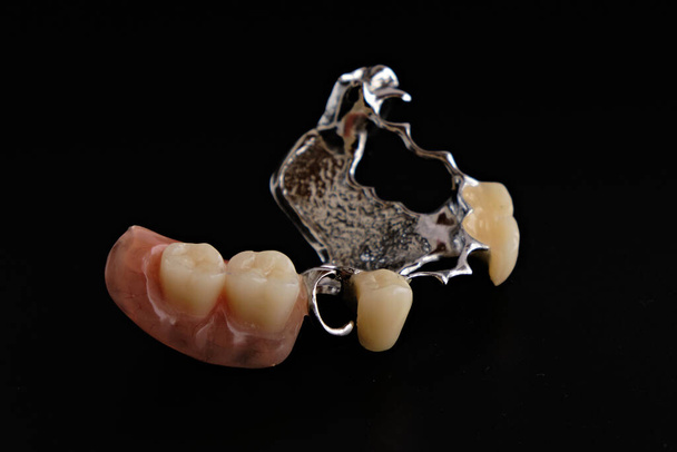 Urządzenia dentystyczne i protezy dentystyczne, na czarnym tle. - Zdjęcie, obraz