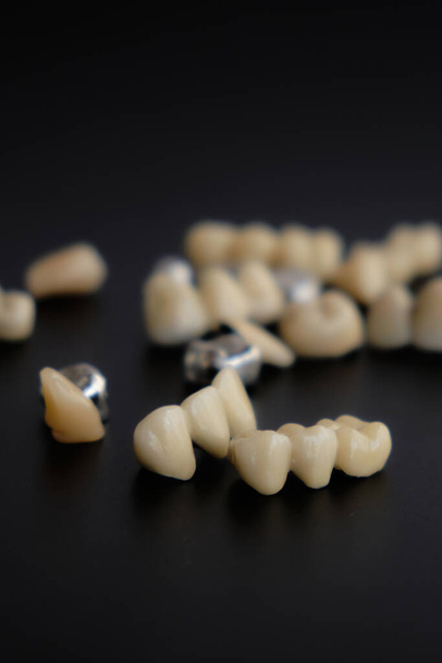 Zubní spotřebiče a zubní protézy, na černém pozadí. - Fotografie, Obrázek
