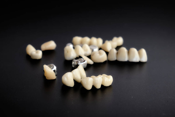 Aparatos dentales y prótesis dentales, sobre fondo negro. - Foto, Imagen