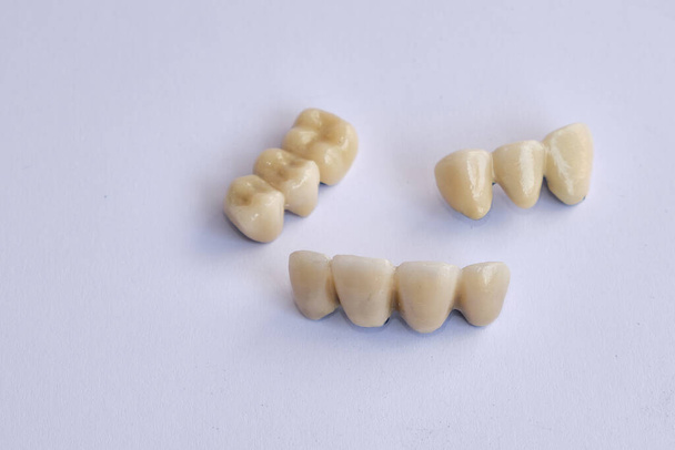 Aparelhos dentários e próteses dentárias.  - Foto, Imagem