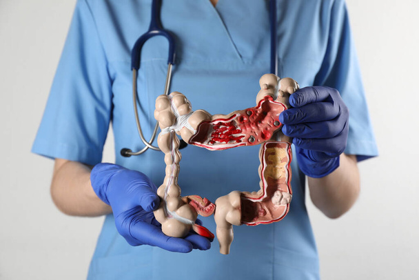 Gastroenterólogo sosteniendo modelo de colon humano sobre fondo blanco, primer plano - Foto, Imagen