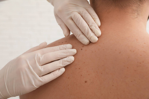 Dermatologist examining patient's birthmark in clinic, closeup - Photo, image