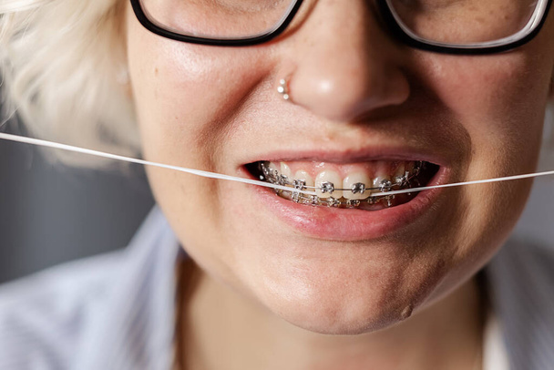 ブレースを持つ若い女性は、彼女の歯を、クローズアップを流れる。口腔衛生と健康管理の概念 - 写真・画像