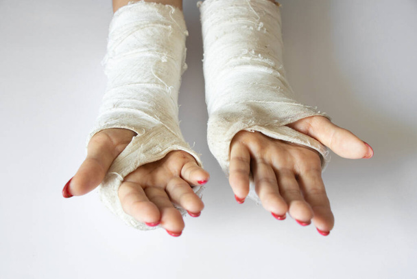 duas mãos femininas com pulsos quebrados depois de cair de uma bicicleta em um molde em um fundo isolado, mãos em um elenco - Foto, Imagem