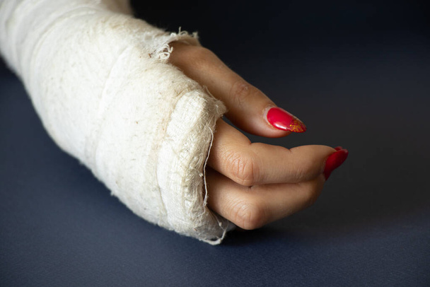 két női kéz törött csuklóval, miután leesett egy kerékpárról egy gipszben egy elszigetelt háttérben, kezek gipszben - Fotó, kép