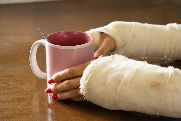 ein Mädchen mit zwei gebrochenen Armen in einem Gips hält eine Tasse Tee in der Küche zum Frühstück, gebrochene Arme in einem Gips, gebrochene Gliedmaßen, Verletzung - Foto, Bild