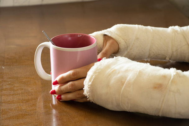 ein Mädchen mit zwei gebrochenen Armen in einem Gips hält eine Tasse Tee in der Küche zum Frühstück, gebrochene Arme in einem Gips, gebrochene Gliedmaßen, Verletzung - Foto, Bild