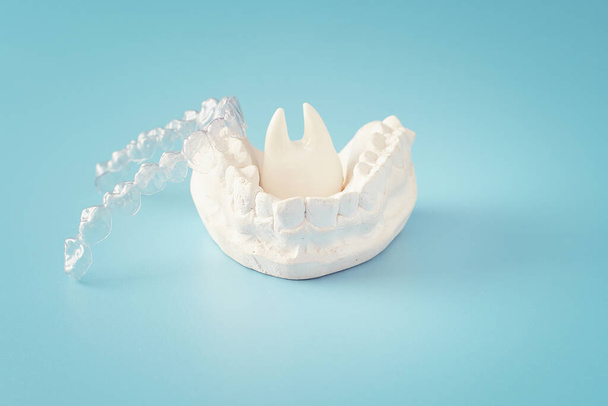 Tema dentale ortodontico su fondo blu Allineatori dentali invisibili trasparenti o bretelle aplicable per un trattamento dentale ortodontico - Foto, immagini