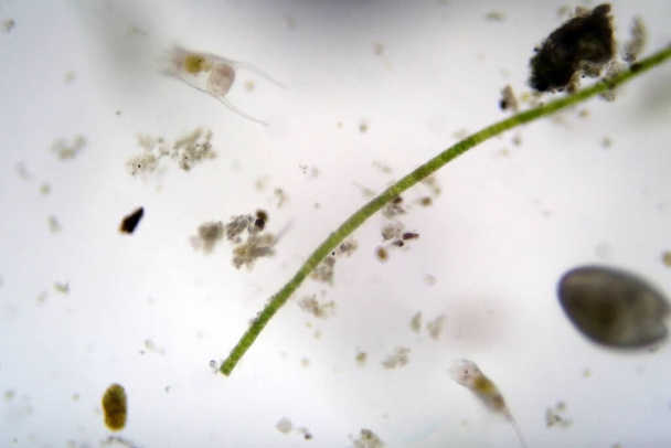Mikroskopijne życie. Mikroskop. Jednokomórkowe zwierzę. Żywy organizm. Patrzyłem przez mikroskop. Życie zwierząt. Mikroskopijny Rotifer lub Rotifera pod mikroskopem, słodkowodny organizm bentic filtrujący wodę. Mikroskopijne życie widziane przez mikroskop.  - Zdjęcie, obraz
