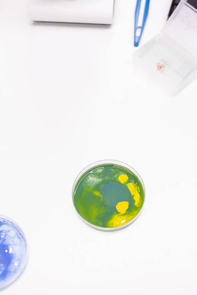 Baktériumkolónia keveréke az asztalon álló petri-csészében a biológiai tudományos kórházi laboratóriumban - Fotó, kép