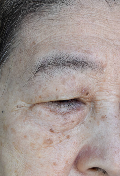 Envejecimiento pliegues de la piel o pliegues de la piel o arrugas y manchas de envejecimiento en la cara, especialmente alrededor de los ojos del sudeste asiático, mujer anciana china. Vista de cerca. - Foto, imagen
