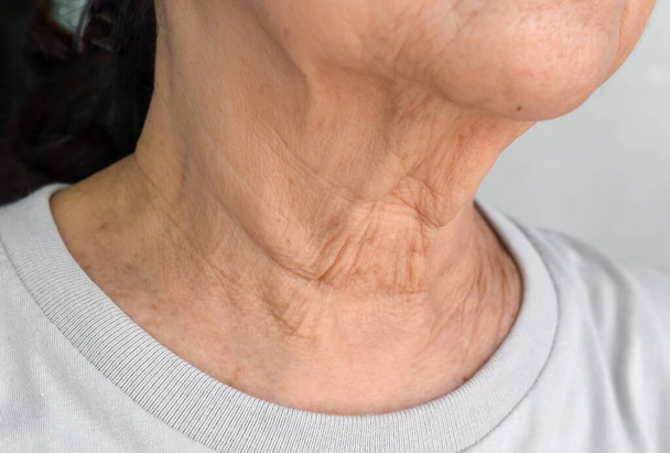 Aging skin folds or skin creases or wrinkles at neck of Southeast Asian, Chinese elderly woman. - Zdjęcie, obraz