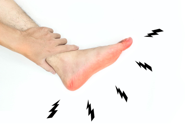 Kribbeln und Brennen im Fuß eines asiatischen jungen Mannes mit Diabetes. Sensorische Neuropathie. Fußnervenprobleme. Isoliert auf Weiß. - Foto, Bild