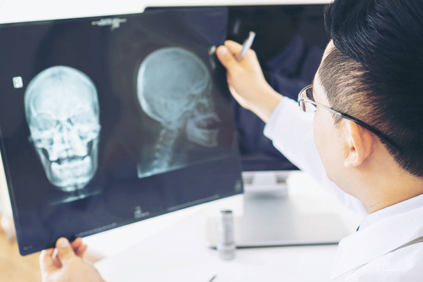 Arzt untersucht Röntgenfilm des Schädels auf weißem Hintergrund - medizinisches Konzept - Foto, Bild
