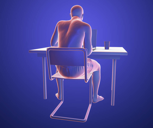 Trabalhando com laptop em uma posição errada e dor nas costas, ilustração 3D - Foto, Imagem