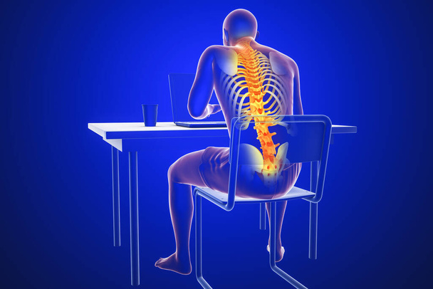 Trabalhando com laptop em uma posição errada. Conceito de dor nas costas, dor nas costas. ilustração 3D mostrando corpo masculino com destaque esqueleto trabalhando em uma posição errada - Foto, Imagem