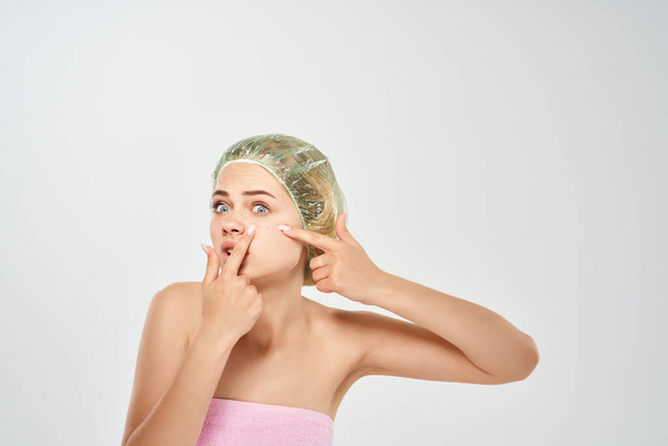 女性は顔の皮膚科の皮膚の問題でにきびを絞る - 写真・画像