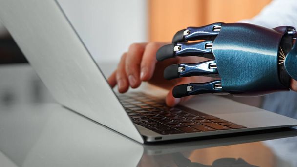 Programador hombre manos con tipo de prótesis bio artificial en el teclado portátil en la mesa bajo la luz del sol brillante - Foto, imagen