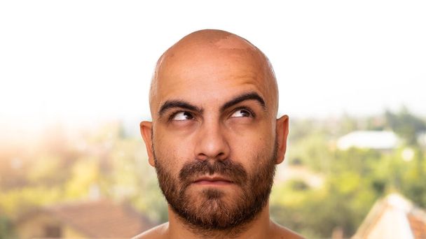 A tanned Caucasian Man with shaved head has a problem with the skin on the top of his head peeling off due to sunburn. He's looking up and to the side as if he's wondering about something. - Photo, Image