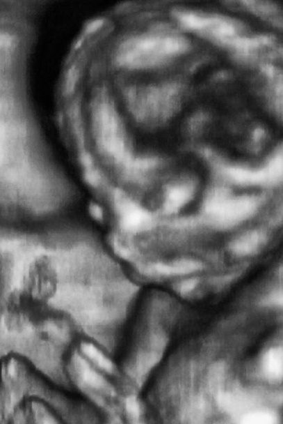 Análisis ultrasonográfico 3D de un feto de cuarto mes, Laboratorios italianos - Foto, Imagen