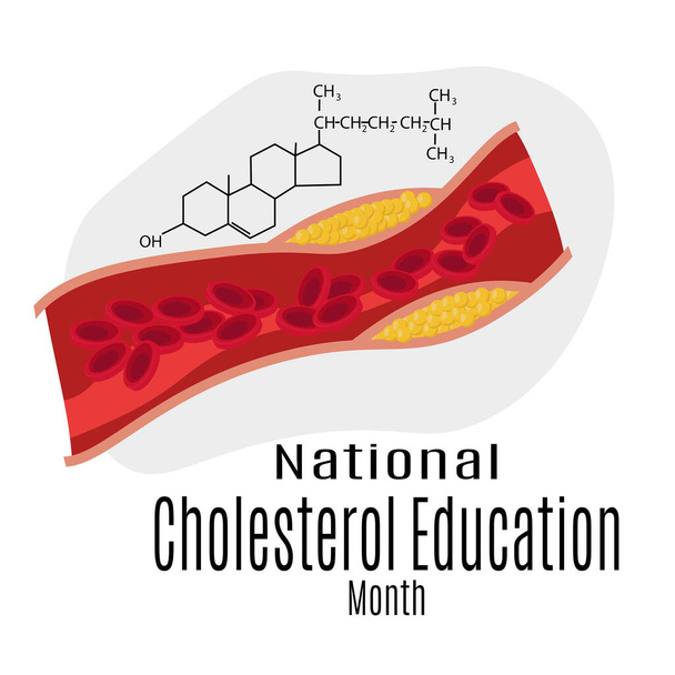 Nemzeti Koleszterin Oktatási Hónap, sematikus kép a koleszterin és kémiai képlet tematikus banner vektor illusztráció - Vektor, kép