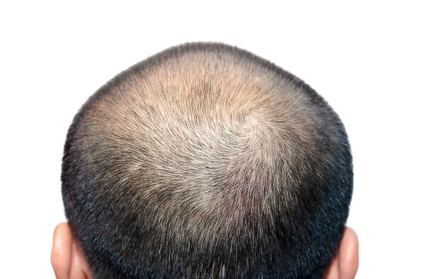 bald head - Photo, Image