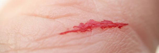Primo piano di graffio con sangue sulla mano dell'uomo - Foto, immagini
