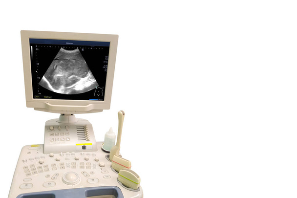 Ultrasonograf izolowany na białym. Obrazowanie brzucha USG. Ultrasonografia. Sonografia diagnostyczna. Medyczne urządzenie diagnostyczne. Wyposażenie szpitala dziecięcego dla dorosłych - Zdjęcie, obraz