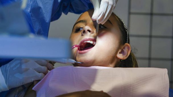 Νεαρή καυκάσια γυναίκα με οδοντίατρο σε λευκά γάντια λατέξ ελέγχουν την κατάσταση των δοντιών της. κοριτσάκι σε μπλε οδοντιατρική καρέκλα - Φωτογραφία, εικόνα
