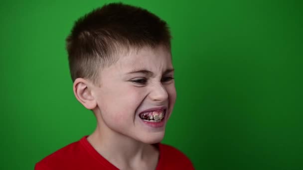 Το αγόρι χαμογελάει, ευθυγραμμίζοντας τα δόντια του με μια οδοντιατρική πλάκα, οδοντιατρική περίθαλψη. - Πλάνα, βίντεο