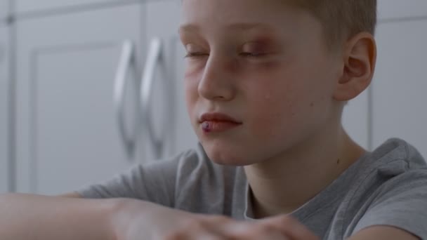 Крупный план избитого мальчика-подростка, плачущего от насилия, сидящего в одиночестве на кухне, смотрящего в сторону на пустое пространство - Кадры, видео