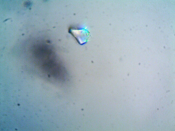 microscopie, photo d'oranisme trouvé par moi - Photo, image