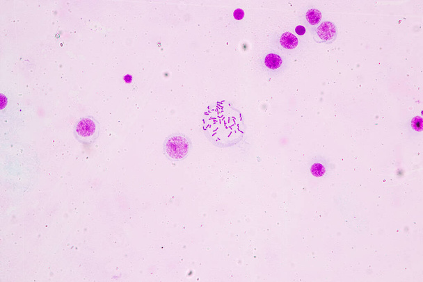 Хромосомы человека под микроскопом для образования. - Фото, изображение