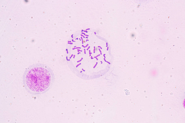 Kromoszómák Emberi az oktatás mikroszkópja alatt. - Fotó, kép