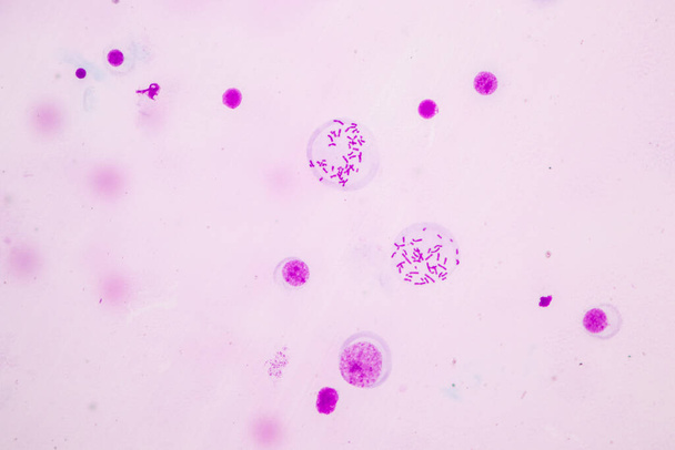Chromosomen Mens onder de microscoop voor onderwijs. - Foto, afbeelding