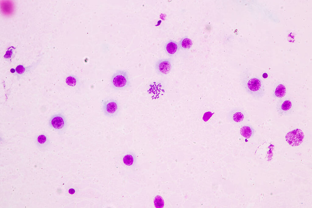 Cromosomas humanos bajo el microscopio para la educación. - Foto, Imagen