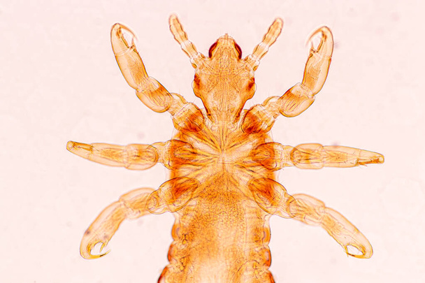 A fejtetű (Pediculus humanus capitis) egy parazita Éljen a test, a személy vagy az állat, és él szívó vér az élelmiszer. - Fotó, kép