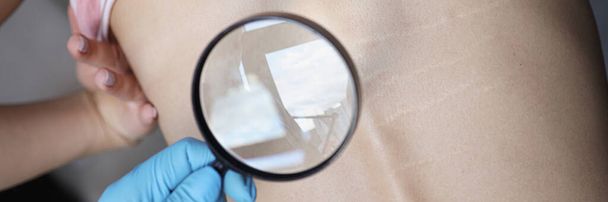 Arzt untersucht Wirbelsäulenprobleme des Patienten durch Lupe - Foto, Bild